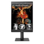MEDICAL 21 LG IPS 3MP DIAGNOSTIC MONITOR, 2048 X 1536