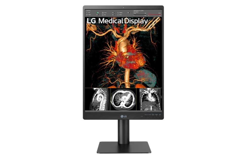 MEDICAL 21 LG IPS 3MP DIAGNOSTIC MONITOR, 2048 X 1536