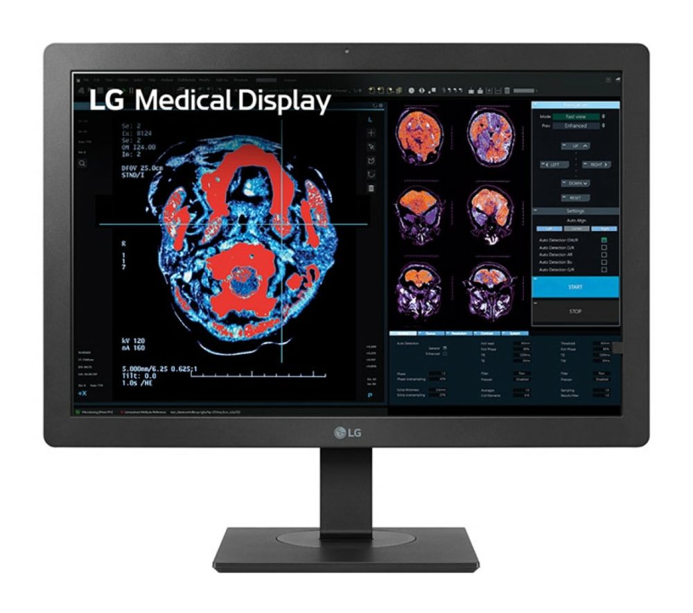 MEDICAL 24 LG IPS 8MP DIAGNOSTIC MONITOR, 1920 x 1200